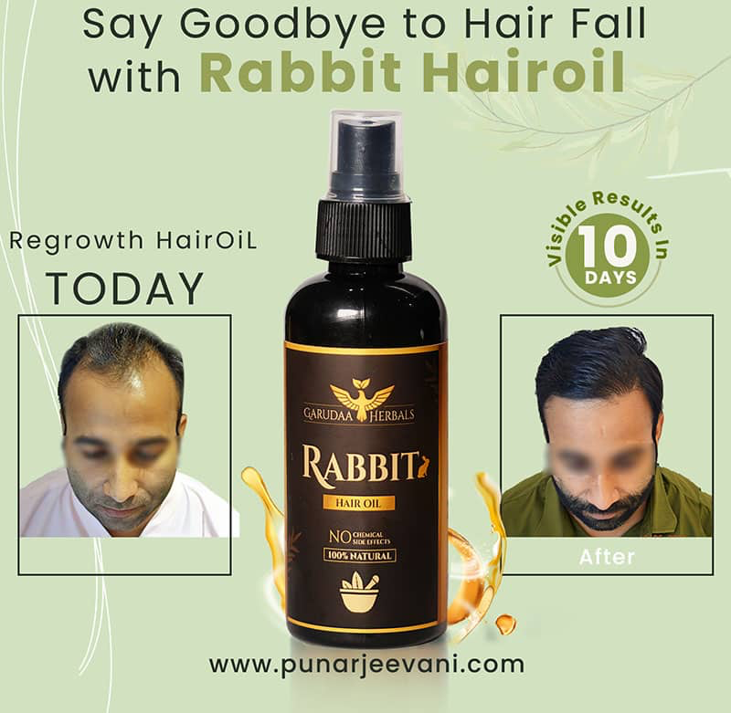 RABBIT HAIR GROWTH HAIR OIL 250 ML